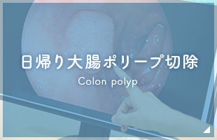 日帰り大腸ポリープ切除