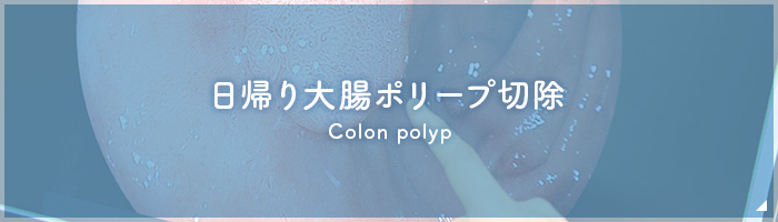 日帰り大腸ポリープ切除